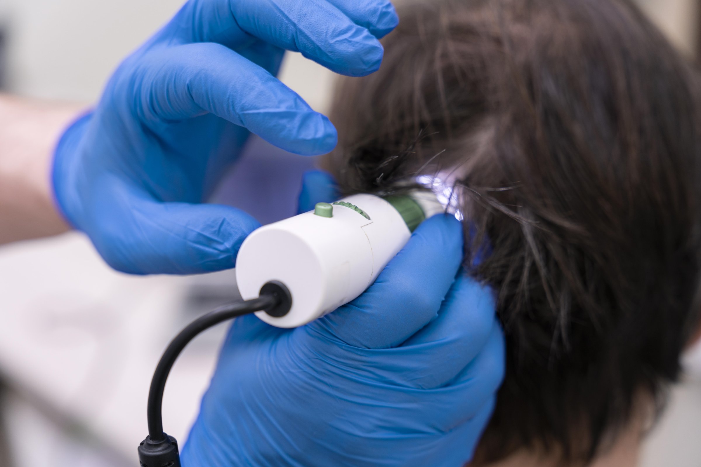 Hair Regrowth Treatment