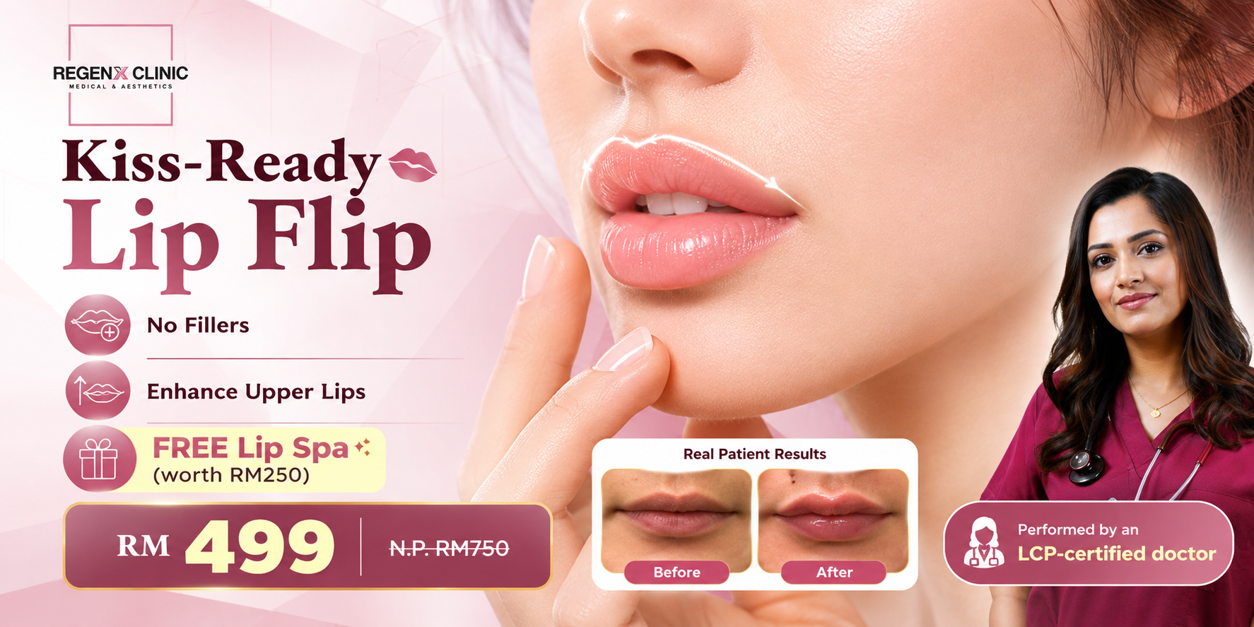 Lip Flip - Fuller Lips without Filler